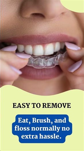 Why More Adults Are Choosing Clear Aligners in 2026 #orthodontist #clearaligners #dentist #vizag