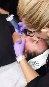 We LOVE @skinpen_uk 💜🫶🏼 Practising what we preach and keeping up with our skin pen treatments ourselves while spending the morning with the lovlie @rachel_crownaesthetics & @simon.ofei_crownaesthetics checking our standards and skills were tip top to make sure we are always offering you guys THE BEST SERVICES 💜✨ Want more info & prices for this treatment drop us a DM 💌💜 introductory prices finish this month so done miss out on saving and having the best skin this 2024 ✨💜 #skin #skinpen #s