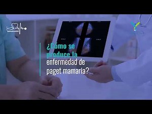 ¿Cómo se produce la enfermedad de Paget Mamaria? Dr. Gastón Mendoza De Lama