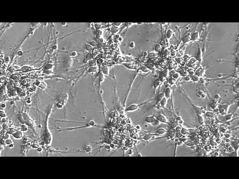 Epic neuronal culture