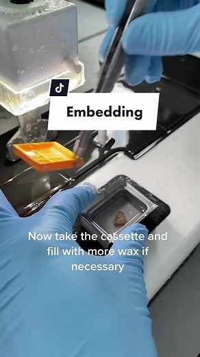 Embedding Techniques in Histopathology Procedures