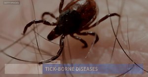 What you need to know about tick-borne disease (part 1)
