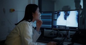 Professional Radiologist Studies Patient X-rays Advanced Stock Footage Video (100% Royalty-free) 3665302817 | Shutterstock