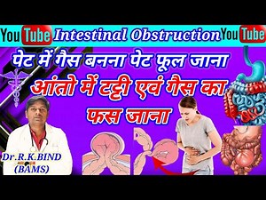 Intestinal Obstruction Bowel Obstruction, Symptoms, Diagnosis and Treatment #video #medicine