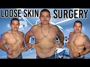 Plans For Loose Skin Surgery