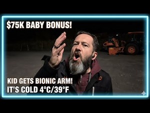$75K Baby Bonus, Girl's Bionic Arm Generosity-it's 4C/39F EP 175