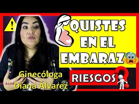 ALL ABOUT CYSTS DURING PREGNANCY, by GYNECOLOGIST DIANA ALVAREZ