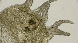 in the body of the hydra, digestive enzymes break down food caught by the Bosmia crab, under a microscope