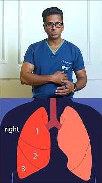 Lobectomy Kya Hai? | Lung Cancer Surgery Explained in 60 Seconds 🩺 #Shorts #lobectomy