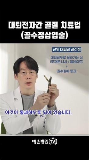 Treatment for intertrochanteric fractures (hip fractures), intramedullary nail insertion