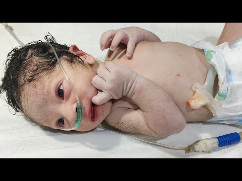 Newborn Baby NVD Delivery | Male Baby Admission & Initial Assessment in NICU | Neonatal Care