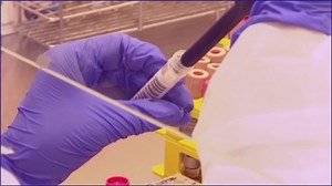 Could the Delta variant put a pause on Ontario’s reopening