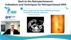 Patient and Tumor Selection for Retroperitoneal Partial Nephrectomy