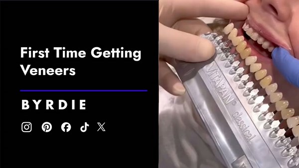 What It's Like Getting Veneers