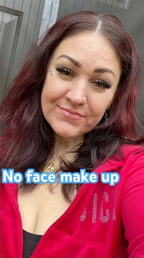 Happy with the results of my skin care and micro dermabrasion. I have a session tomorrow.