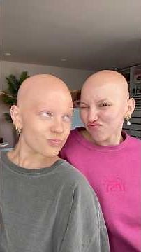 The difference in our types of Alopecia￼