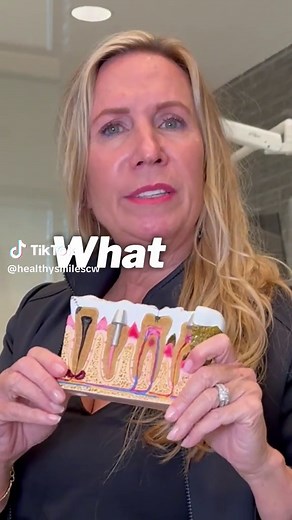 ☠️🦷What is a dead tooth? A dead tooth is when the nerve has actually died, and you have an abscess underneath your tooth. The two choices to solve it are a root canal or an extraction. Follow us to learn more about which option is the best! #rootcanals #oralcare #holisticdentist