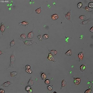 File:Hyphal-Growth-of-Phagocytosed-Fusarium-oxysporum-Causes-Cell-Lysis-and-Death-of-Murine-Macrophages-pone.0101999.s001.ogv - Wikimedia Commons