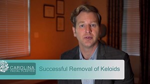 Successful Removal of Keloids