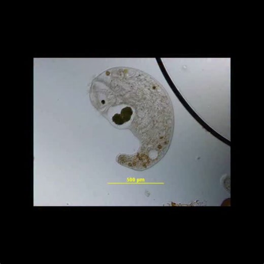 Algaltechnology on Instagram‎: "A fascinating moment under the microscope 🔍 A Stentor rotating again and again, seemingly deciding the fate of its captured Botryococcus 🟢 Notice the distinctive lobed macronucleus — a hallmark of this remarkable ciliate. 🧫🌊 #microscopy #protists #stentor #microbiallife #botryococcus CellBiology ScienceReels یک صحنه شگفت‌انگیز زیر میکروسکوپ 🔍 استنتور بارها و بارها به دور خود می‌چرخد، انگار در حال تصمیم‌گیری درباره سرنوشت بوتریوکوکوس به دام افتاده است 🟢 به ما