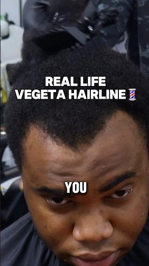 VEGETA HAIRLINE IRL