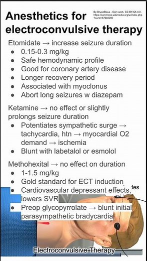 Anesthetics for electroconvulsive therapy
