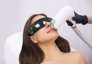 Laser Pigmentation Treatment