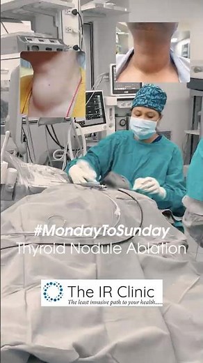A Week of Thyroid Nodule Ablation with Dr. Parul Garg 🦋 | Multiple Real Cases
