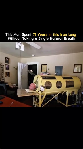 This man spent an unbelievable 71 years inside an iron lung—without taking a single natural breath. His name was Paul Alexander, one of the last survivors of the polio epidemic. The virus paralyzed his body when he was just six years old. Since then, the iron lung became his only way to breathe. It uses air pressure to pull and push air from his lungs mechanically. For over seven decades, he lived, studied, worked, and even became a lawyer—all from inside the machine. Every sound of that motor k
