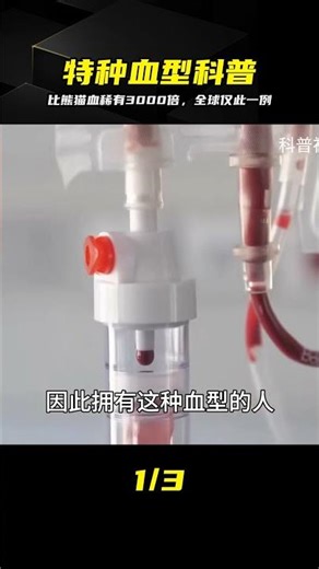 “黃金血”究竟是什么？比熊貓血稀有3000倍，全球僅有1例 #黄金血，熊猫血，稀有血型，世界罕见，罕见案例