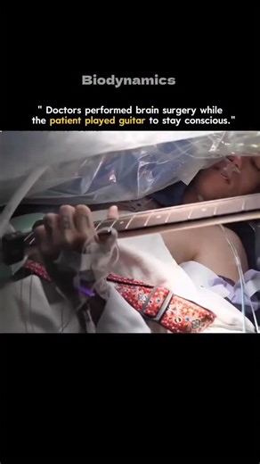 Medical | Science | Facts on Instagram: "Doctors performed brain surgery while the patient played guitar on the operating table. The reason? To keep him conscious and monitor his brain’s motor functions in real time. Every note he played helped surgeons avoid damaging vital areas controlling movement. It’s called awake brain surgery, one of the most precise procedures in medicine. The operation required perfect coordination between surgeons, anesthetists, and the patient. Even the slightest wron