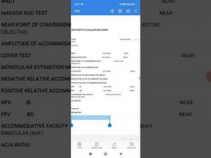 Orthoptic Evaluation || How to perform