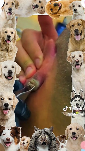 Guide to Cyst and Blackhead Removal