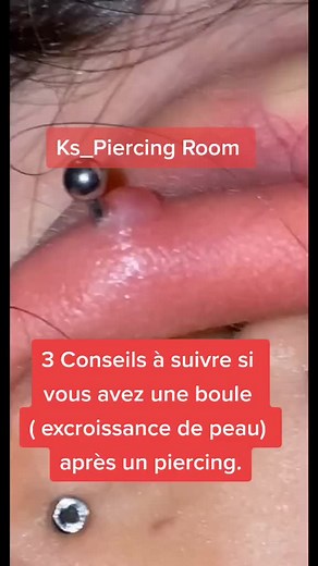 3 Conseils pour Éviter les Boules après un Piercing