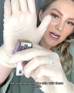 31 reactions · 22 comments | PSA: This is the secret treatment that's behind all the incredible celebrity post-pregnancy photos. This same treatment is also used in their anti-aging routines. Morpheus 8 is helps: ✅ Sagging facial or neck skin ✅ Loose body skin post pregnancy, weight loss, or general ageing. ✅ Deep lines and creases ✅ Sun damage and poor skin texture Find out more! Tap the 'Book Now' button ➡️ | Contour Clinics | Facebook