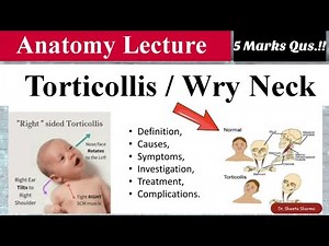 Torticollis/ Wry Neck- Anatomy Lecture| Dr.Shweta Sharma