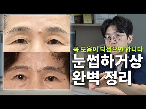 눈썹하거상 정말 꼭 필요한 내용입니다 (회복기간,부작용,흉터,성공여부,효과)