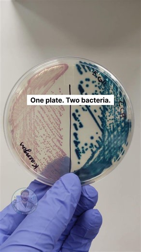 E. coli vs Coliforms – The Plate Never Lies! 🦠#biology #shorts #science