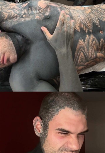Getting all of the nasty areas done all at once.. that way it can all heal at the same time #blackouttattoo #tattoo
