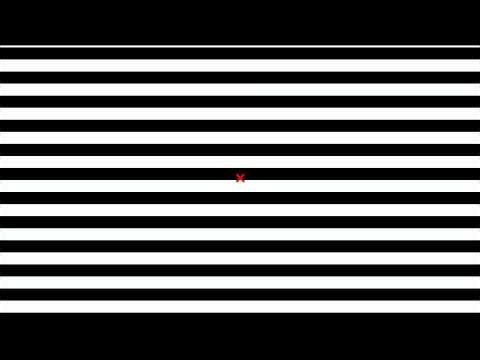 Gaze Stabilization VOR Exercise with 160bpm metronome and downward scrolling optokinetic lines