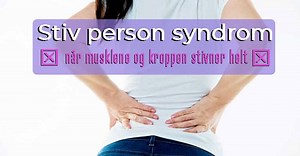 Stiv person syndrom: Når kroppen og musklene stivner helt