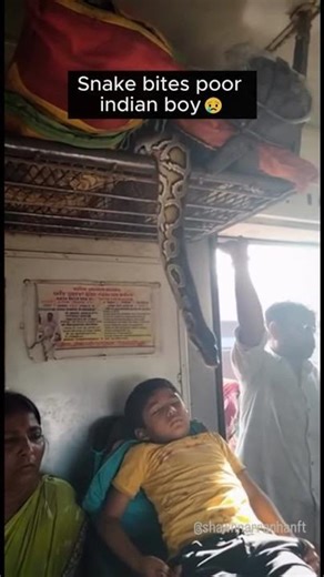 Snake Bites indian Boy :(