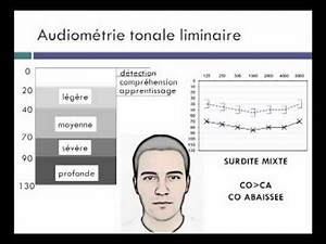 exploration de la fonction auditive