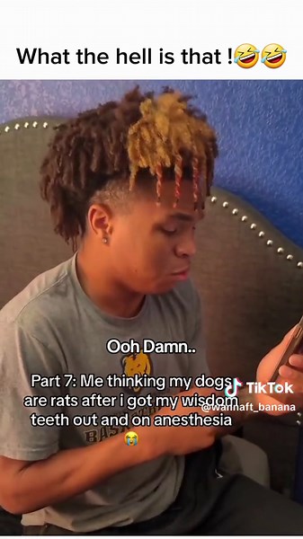 Hilarious Wisdom Teeth Scream Compilation