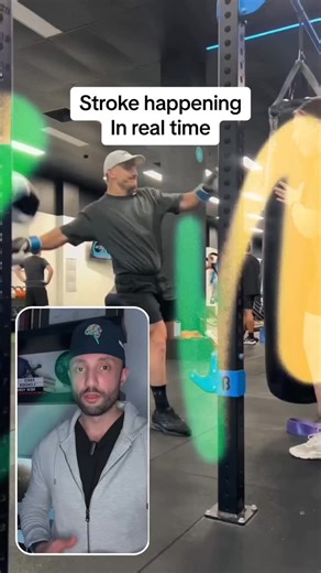 This is what an ischemic stroke can look like. Be aware of the symptoms. #neurology #stroke #strokesurvivor #brain #neurosurgery #doctor #medical #medgram | Dr.Z Neurosurgery