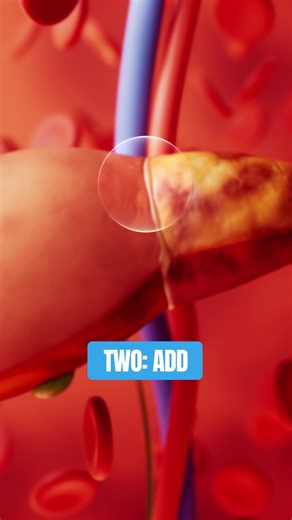 100 million Americans are on track to develop fatty liver disease, but the good news is that you can turn it around! In this video, I’m sharing 5 ways to heal your liver naturally. | Dr. Livingood