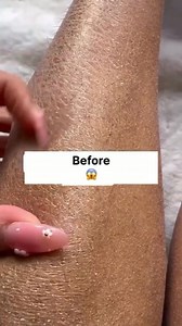 26K views · 102 reactions | Repair Dry Cracked Feet In 1 Day | Get Soft & Smooth Glowing Feet, Get Rid Of Cracked Feet #softskin #Skincare #crackedskin #glowingskin #dryskincare #dryness #viralreels #videoviral | Health Beauty Treat | Facebook