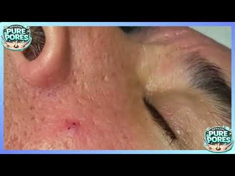 MEGA COMPILATION #19 - Official Pure Pores Skin Care React to Soothing facial treatments ASMR
