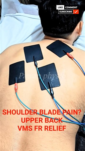 Shoulder Blade & Upper Back Pain Treatment | Scapular Pain Relief | VMS FR Therapy#physiotherapist