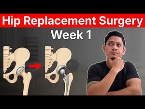 Hip Replacement Recovery: What To Expect Days 1-7 Post-Op